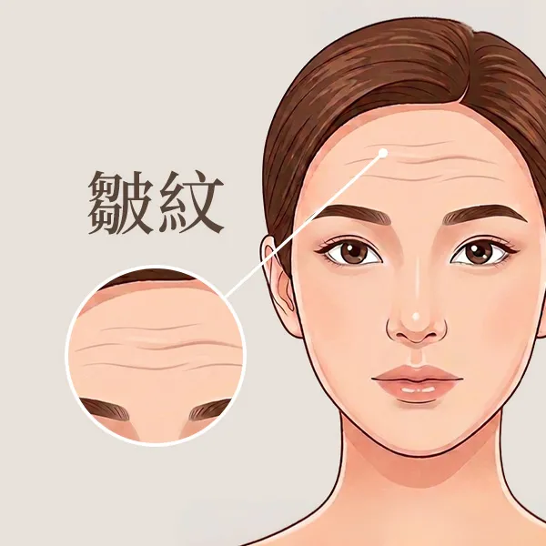 皺紋