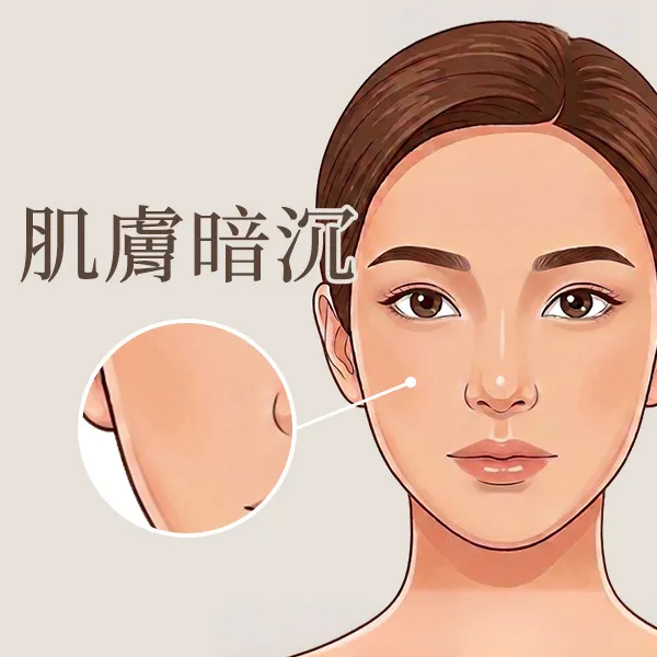 肌膚暗沉