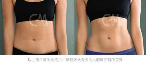 增肌減脂馬甲線前後效果比對