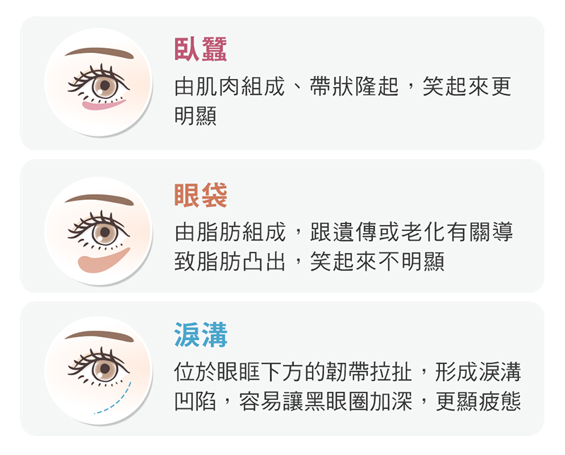 眼袋-淚溝-臥蠶分別