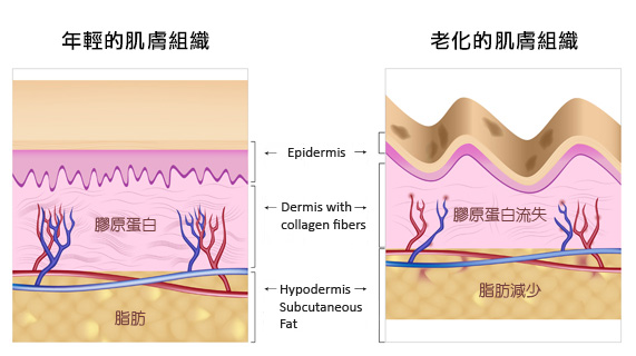 雙波拉提-雙波拉提效果-電波拉提療程推薦