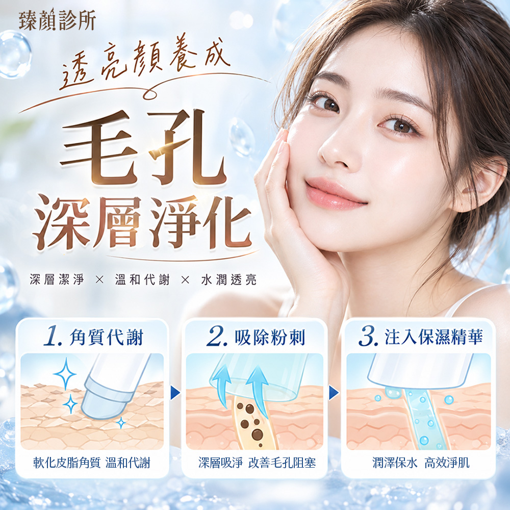 毛孔深層淨化-清粉刺-青埔醫美--水飛梭
